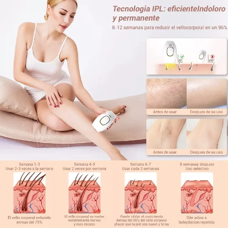 Depilador laser IPL